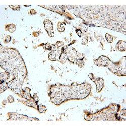 BTB/POZ Domain-Containing Protein TNFAIP1 (TNFAIP1) Antibody