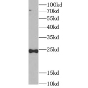 WB analysis of SW620 cells, using TNFSF12 antibody (1/1000 dilution).