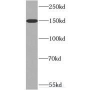 WB analysis of HeLa cells, using TNKS antibody (1/1000 dilution).