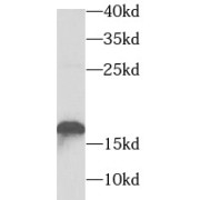 WB analysis of mouse skeletal muscle tissue, using TNNC2 antibody (1/1000 dilution).