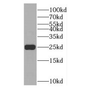 WB analysis of human skeletal muscle tissue, using TNNI1 antibody (1/1200 dilution).