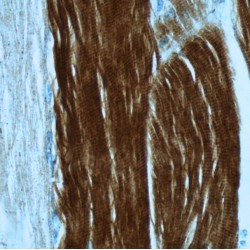 Troponin I, Fast Skeletal Muscle (TNNI2) Antibody