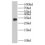 WB analysis of mouse skeletal muscle tissue, using TNNT1 antibody (1/1500 dilution).