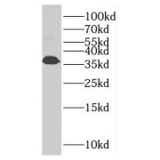 WB analysis of rat skeletal muscle tissue, using TNNT3 antibody (1/1000 dilution).