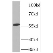 WB analysis of HeLa cells, using TOE1 antibody (1/500 dilution).