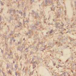 Toll-Interacting Protein (TOLLIP) Antibody