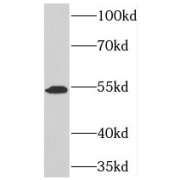 WB analysis of human liver tissue, using TOM1 antibody (1/600 dilution).