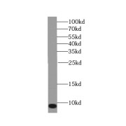 WB analysis of human skeletal muscle tissue, using TOMM6 antibody (1/400 dilution).