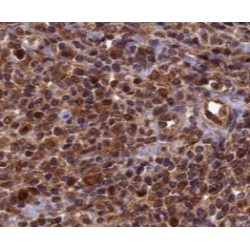 Topoisomerase I (TOP1) Antibody