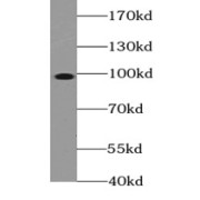 WB analysis of L02 cells, using TOP1 antibody (1/1000 dilution).