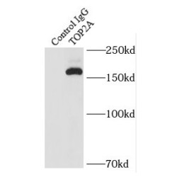 Topoisomerase (DNA) II Alpha (TOP2A) Antibody