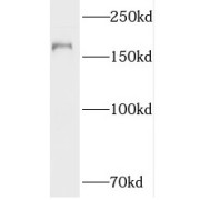 WB analysis of HeLa cells, using TOP2A antibody (1/1000 dilution).