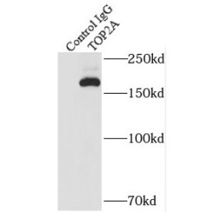 TOP2A-Specific Antibody