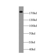 WB analysis of HeLa cells, using TOP2A-Specific antibody (1/400 dilution).