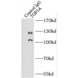 DNA Topoisomerase 3-Alpha (TOP3A) Antibody