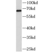 WB analysis of PC3 cells, using P63 antibody (1/1000 dilution).