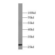 WB analysis of HepG2 cells, using TPI1 antibody (1/2000 dilution).