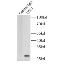 Tau-Protein Kinase 1 (TPK1) Antibody