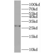 WB analysis of mouse kidney tissue, using TPK1 antibody (1/1000 dilution).