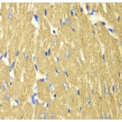 Tropomyosin Alpha-3 Chain (TPM3) Antibody