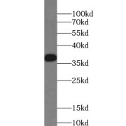 WB analysis of mouse skeletal muscle tissue, using TPM3 antibody (1/1000 dilution).