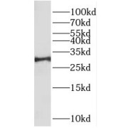 WB analysis of human kidney tissue, using TPMT antibody (1/300 dilution).