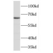 WB analysis of human colon tissue, using TPP1 antibody (1/300 dilution).