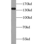 WB analysis of Jurkat cells, using TPP2 antibody (1/1000 dilution).