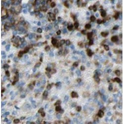 Tubulin Polymerization Promoting Protein (TPPP) Antibody