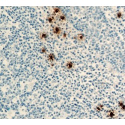 Tryptase Alpha/Beta-1 (TPSAB1) Antibody