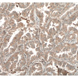 Tryptase Delta (TPSD1) Antibody