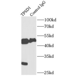 Tryptase Delta (TPSD1) Antibody