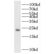 WB analysis of PC-3 cells, using TPT1 antibody (1/1000 dilution).