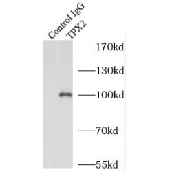 Targeting Protein For Xklp2 (TPX2) Antibody