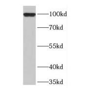 WB analysis of HepG2 cells, using TPX2 antibody (1/5000 dilution).