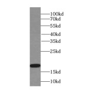 WB analysis of HeLa cells, using TR2IT1 antibody (1/300 dilution).