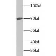 WB analysis of mouse brain tissue, using TRAF3 antibody (1/1000 dilution).