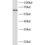 WB analysis of Jurkat cells, using TRAF5 antibody (1/1000 dilution).