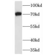WB analysis of mouse heart tissue, using TRAF7 antibody (1/300 dilution).