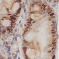 Tumor Necrosis Factor Related Apoptosis Inducing Ligand (TRAIL) Antibody