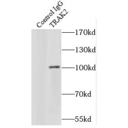 Trafficking Kinesin-Binding Protein 2 (TRAK2) Antibody