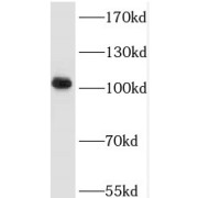 WB analysis of human liver tissue, using TRAK2 antibody (1/500 dilution).