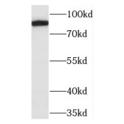 WB analysis of human heart tissue, using TAGLN2 antibody (1/600 dilution).