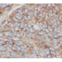 Transgelin 2 (TAGLN2) Antibody