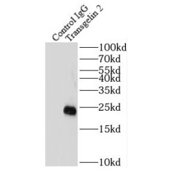 Transgelin 2 (TAGLN2) Antibody