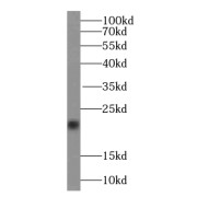 WB analysis of K-562 cells, using TAGLN2 antibody (1/1000 dilution).