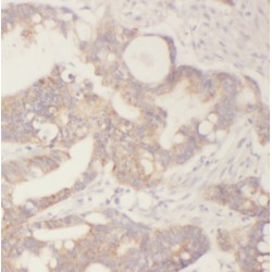 transgelin / SM22 Antibody