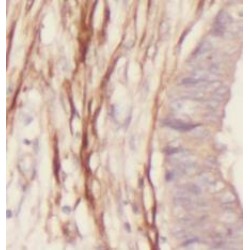 transgelin / SM22-specific Antibody