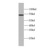 WB analysis of human brain tissue, using TKT antibody (1/1000 dilution).