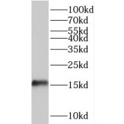 WB analysis of mouse bladder tissue, using TRAPPC2L antibody (1/300 dilution).